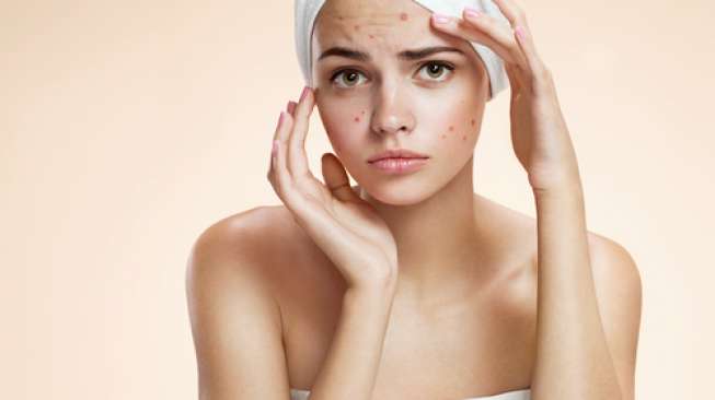 tips skincare untuk kulit berjerawat